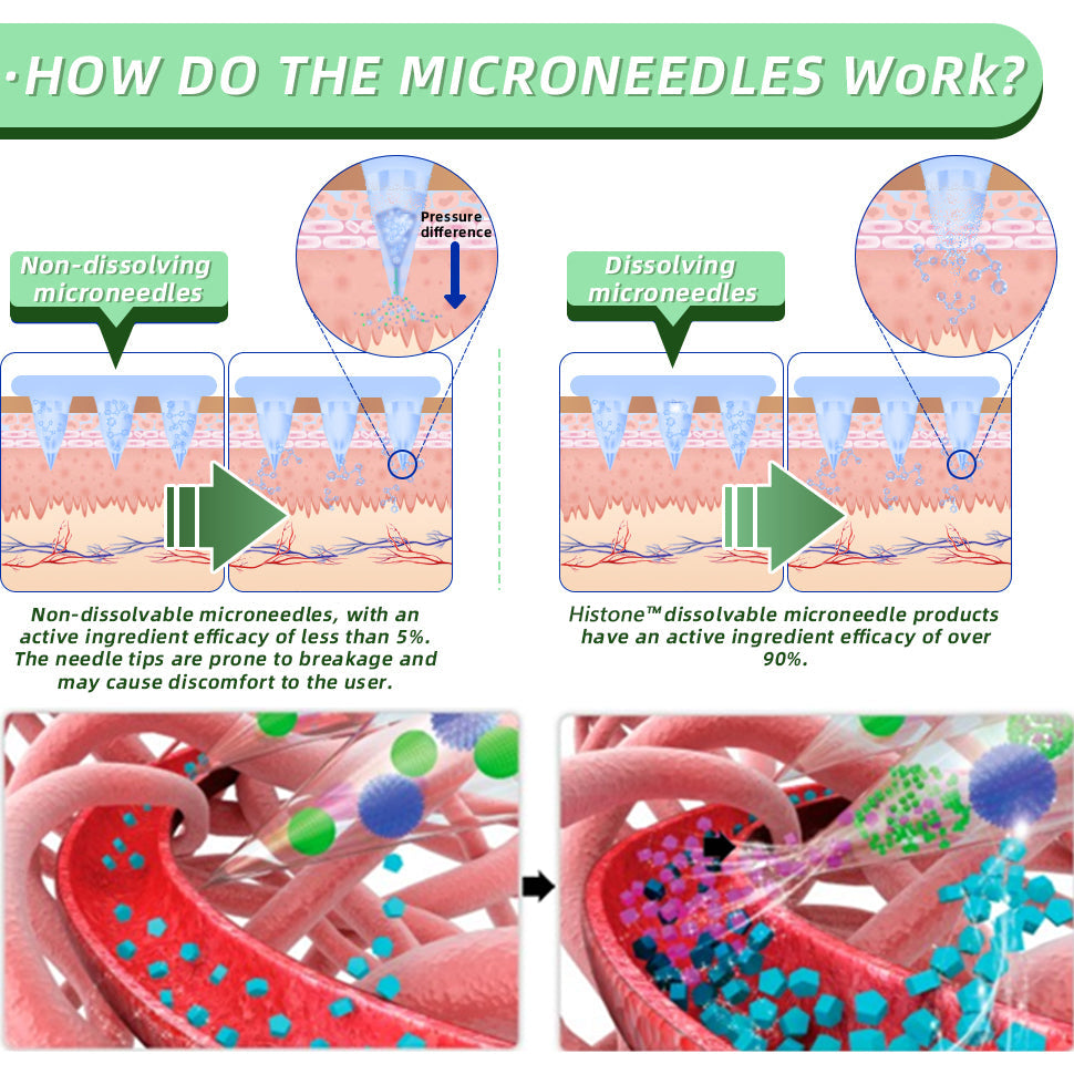 Histone™ SMGT-GLP-1 Nano Microneedle Patch
